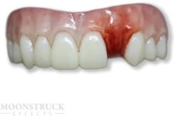 Anwen Missing U7 Neptanden